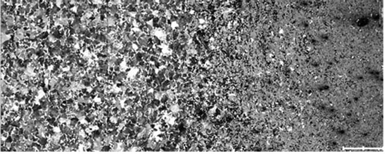 表面硬化層（馬氏體）和核心（珠光體）的微觀結構示例